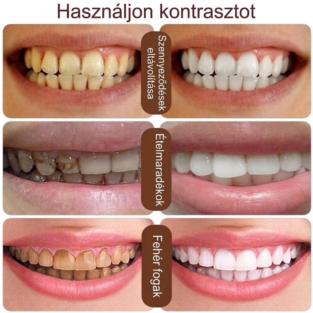 AICHUN BEAUTY™ Arab kávés fogfehérítő fogkrém – friss lehelet - Image 5